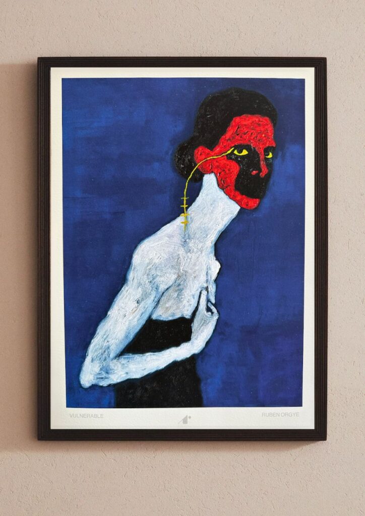 VULNERABLE, giclée fine art print by Ruben Orgye — ARTIS Gallery, Barcelona